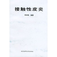 接触性皮炎