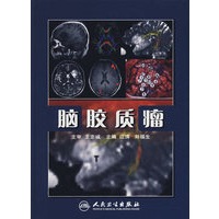 脑胶质瘤