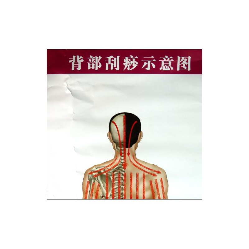 《背部刮痧示意图气管炎哮喘保健图解\/常见病保健