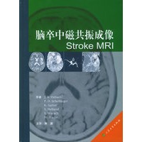 脑卒中磁共振成像