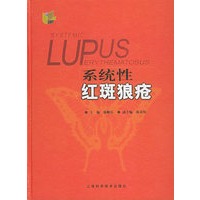 系统性红斑狼疮