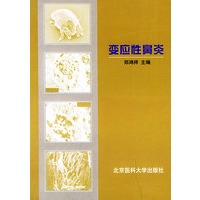 变应性鼻炎